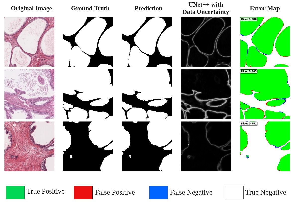 Gland Segmentation